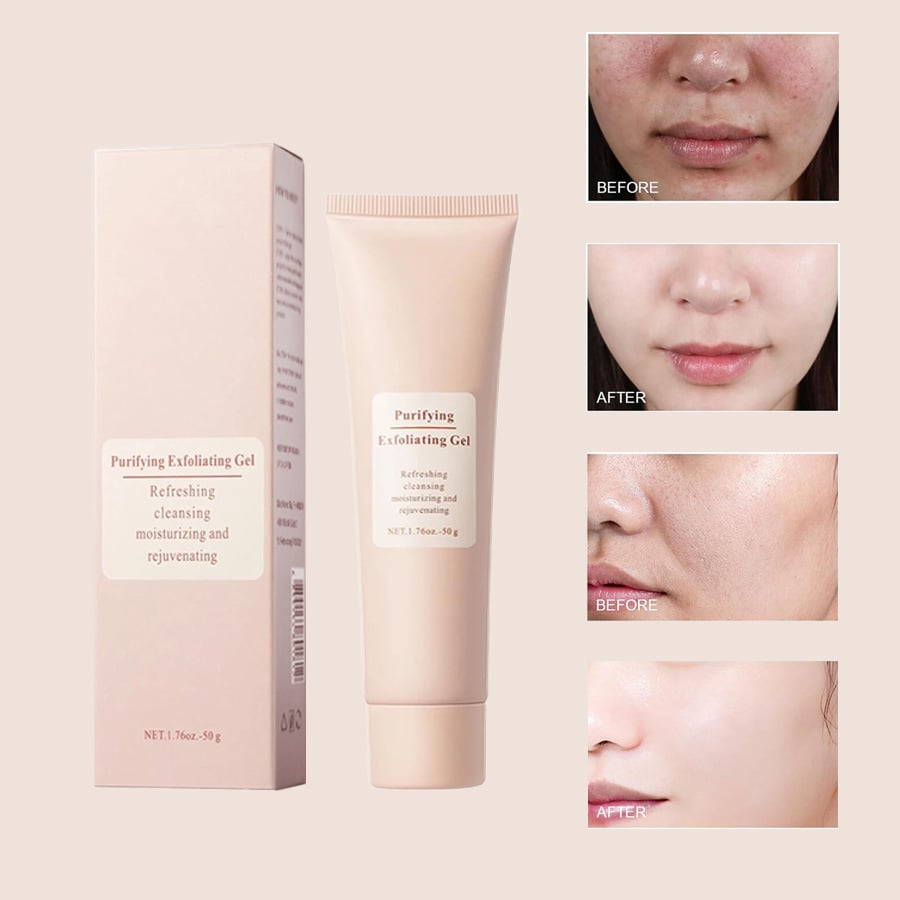 🎉Summer Sale 49% OFF - 🔥Purifying Exfoliating Gel