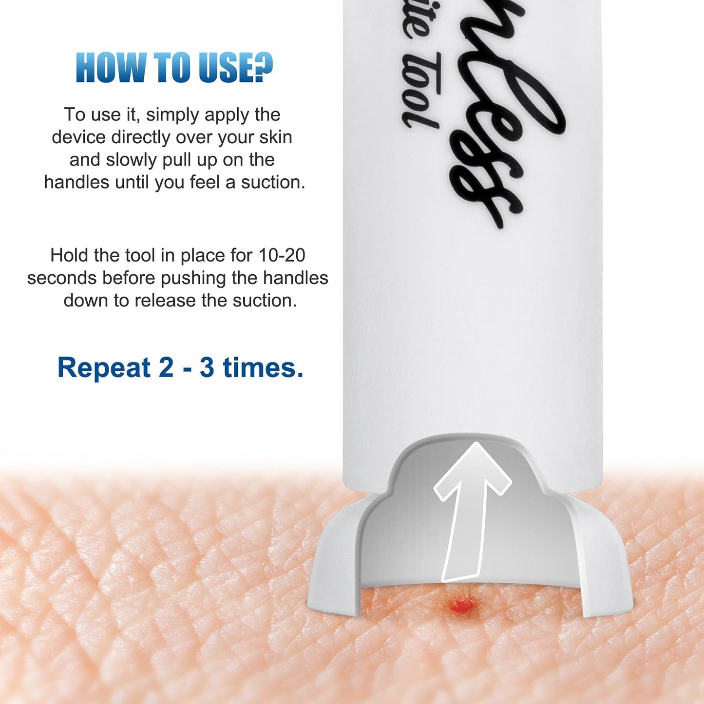 Poison Remover - Bug Bites and Bee/Wasp Stings, Natural Insect Bite Relief Bites Relief Suction Tool