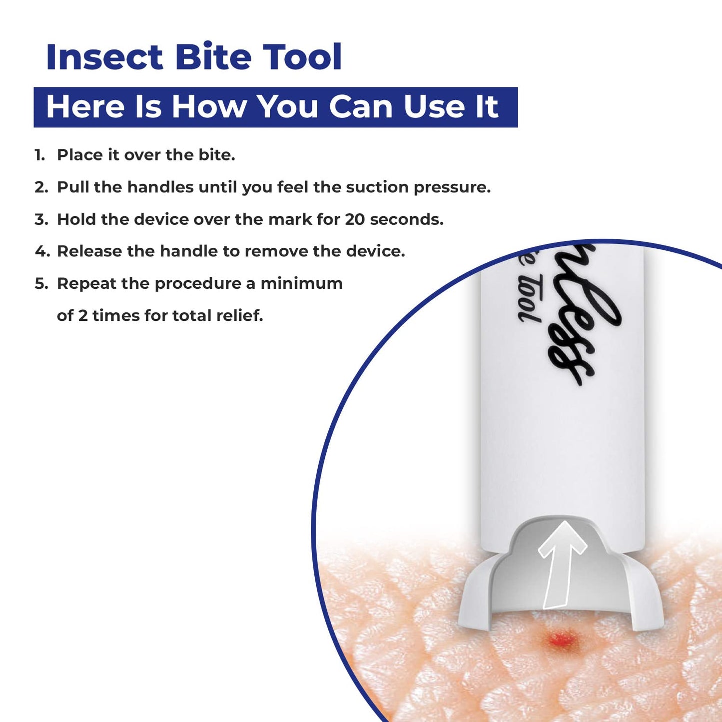 Poison Remover - Bug Bites and Bee/Wasp Stings, Natural Insect Bite Relief Bites Relief Suction Tool