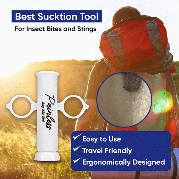 Poison Remover - Bug Bites and Bee/Wasp Stings, Natural Insect Bite Relief Bites Relief Suction Tool