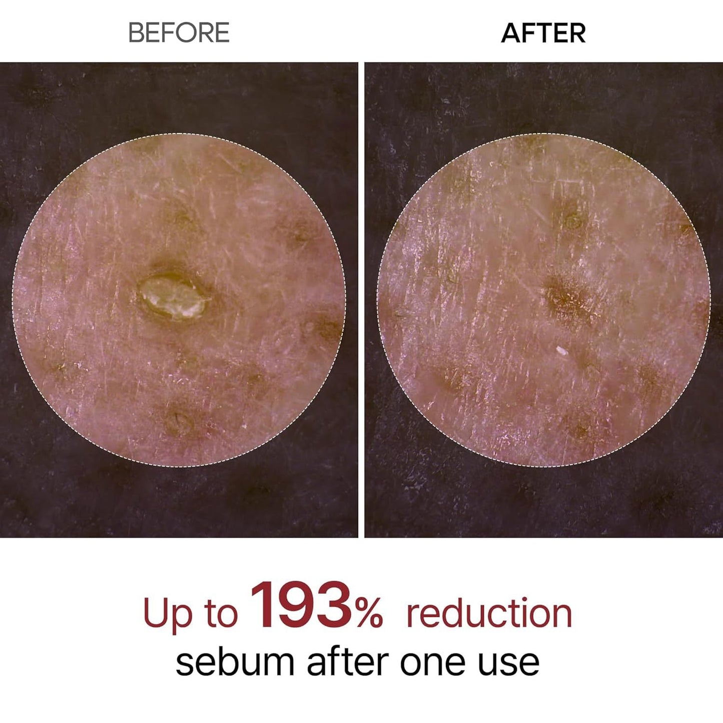 💖 Summer Must-Have! Soft Peel Ampoule – Dead Skin Be Gone! 🧼