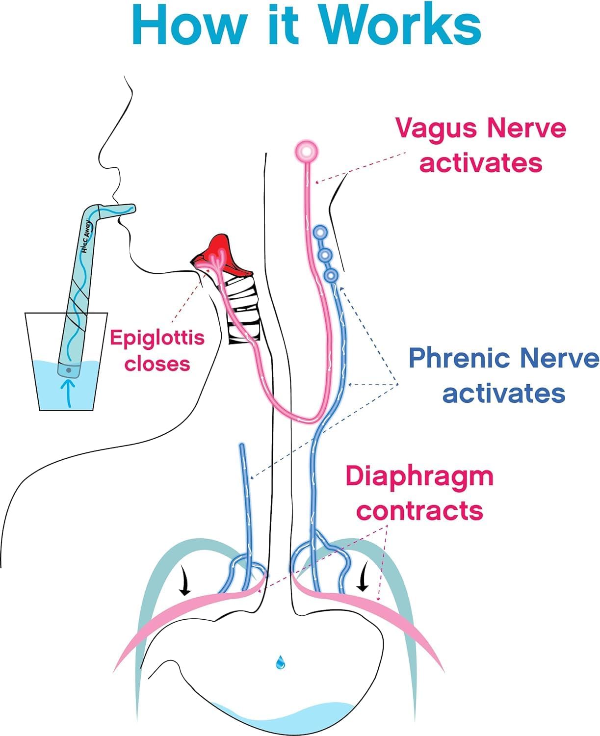 🔥Buy 2 Get 1 FRRE⏰--Hiccup Straw - Stops Hiccups Fast